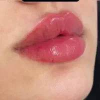 دوره آموزش تزریقات زیبایی( فیلر ، ژل ، بوتاکس)