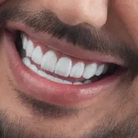 کامپوزیت دندان|خدمات آرایشگری و زیبایی|بروجرد, |دیوار