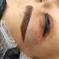 آف فیبروز ابرو