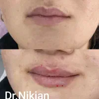 کلینیک زیبایی دکتر نیک جان تخفیف ویژه افتتاحیه