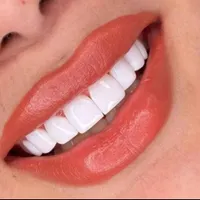 دیگر نگران هزینه‌های سنگین خدمات دندانپزشکی نباشید|خدمات آرایشگری و زیبایی|شیراز, ملاصدرا|دیوار