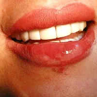 خدمات دندانپزشکی|خدمات آرایشگری و زیبایی|پارسآباد, |دیوار