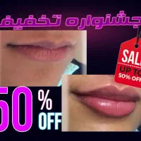 مطب تزریق ژل لب تخفیف لیزر فیلر لیفت صورت بوتاکس