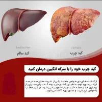 سرکه انگبین(شاه دارو)|خوردنی و آشامیدنی|یزد, |دیوار