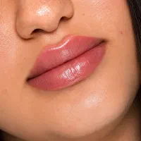 فیلر و بوتاکس