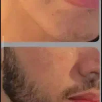 ریش مردانه با پکیج جادویی