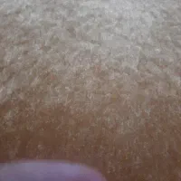 تشک زخم بستر