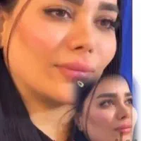 جشنواره پاییزه زیبایی ژل بوتاکس لیزر مزو|خدمات آرایشگری و زیبایی|رشت, نامجو|دیوار