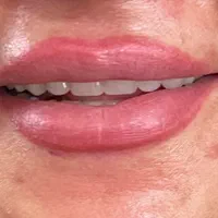دست دندان متحرک/تعمیر دندان مصنوعی|خدمات آرایشگری و زیبایی|کرج, چهارصد دستگاه|دیوار
