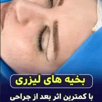 تخلیه غبغب،لیپوساکشن بازو،شکم،بلفاروابدوماموپلاستی|خدمات آرایشگری و زیبایی|اهواز, نادری|دیوار