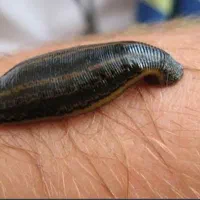 زالو انداختن