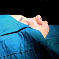 عمل زیبایی بینی|خدمات آرایشگری و زیبایی|حمیدیه, |دیوار