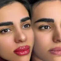 تخفیف شیدینگ لب