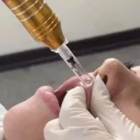 تزریق ژل، بوتاکس