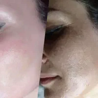 رفع پیسی گلوتاتون سفیدکننده صورت وبدن تضمینی|خدمات زیبایی و سلامت|اهواز, کیانپارس |دیوار