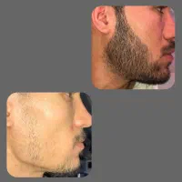 حرکت از تو ریش و سیبیل و مو از ما