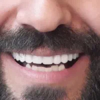 دندان مصنوعی دندانسازی بامجوز رسمی و ۵۰درصدتخفیف|پزشکی|مشهد, پایین خیابان|دیوار