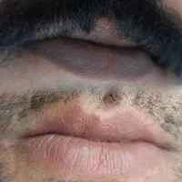 سالن تخصصی میکروپیگمنتیشن و زیبایی