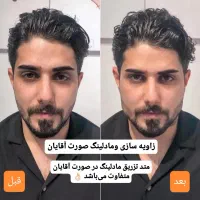 جشنواره/فیلر/بوتاکس/آنزیم/تخفیف دکترفیروزی|خدمات آرایشگری و زیبایی|شیراز, زرهی|دیوار