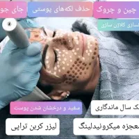 لیزر موهای زاید(رایگان) آقایان بانوان حذف تتو|خدمات آرایشگری و زیبایی|نجف‌آباد, بازار|دیوار