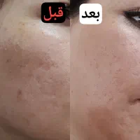 جوانساز|آرایشی، بهداشتی، درمانی|شیراز, ستارخان|دیوار