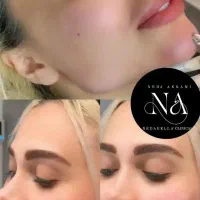 ژل لب و مادلینگ 450 هزارتومان توسط پزشک کلینیک|خدمات زیبایی و سلامت|کرج, گوهردشت|دیوار