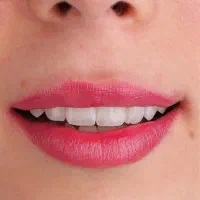 دندانپزشکی دقیق و منصفانه|خدمات زیبایی و سلامت|کرمانشاه, |دیوار