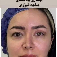 مرکز تخصصی بلفارو‌پلاستی و ساکشن غبغب