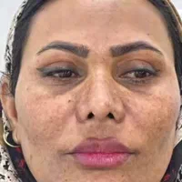 کرم لک سفید کننده فیلیپینی|آرایشی، بهداشتی، درمانی|بندرعباس, |دیوار