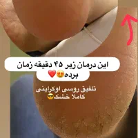 اموزش تخصصی پدیکور اسمارت مجازی و حضوری|خدمات آموزشی|یزد, |دیوار