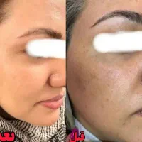 مشاور نمایندگی محصولات لاکچری کوین،ویتابلا|آرایشی، بهداشتی، درمانی|الیگودرز, |دیوار
