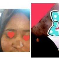 ورکشاپ تخصصی پوست (پاکسازی)|خدمات آموزشی|سیرجان, |دیوار