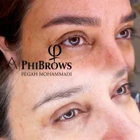 میکرو و موخوره گیری