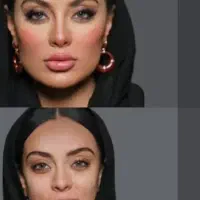 به منظور افتتاحیه مطب جوانساز آبرسانی ولیزر رایگان