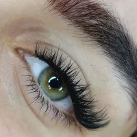 کاشت هیدن ۲۵۰ فشیال و پاکسازی ۳۵۰