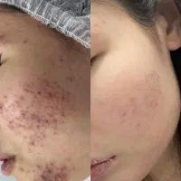 خدمات و آموزش تخصصی فشیال|خدمات آرایشگری و زیبایی|پاکدشت, پاکدشت (مامازند)|دیوار