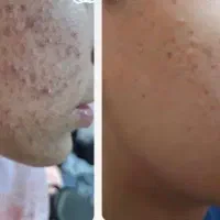 درمان تخصصی پوست