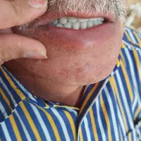 ساخت دندان مصنوعی|پزشکی|سنندج, |دیوار