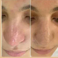 پاکسازی پوست با قیمت استسنائی|خدمات آرایشگری و زیبایی|مشهد, تلگرد|دیوار