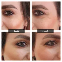 مدل ژل کل صورت