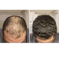 این یه روشه مخصوصه