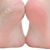 پدیکور و کف سابی