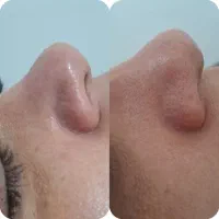 فشیال حرفه ای پوست منزل و کلینیک