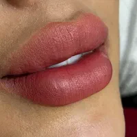 جشنواره تزریق ژل و بوتاکس ،فیلر لب روسی ،مزو