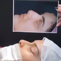 جشنواره بلفارو پلاستی پلک فقط 8500|خدمات آرایشگری و زیبایی|اصفهان, بهار آزادی|دیوار