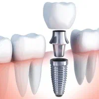دندانپزشکی (قیمت مناسب و اقساط)