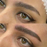 مدل میکروبلیدینگ فیبروز شیدینگ لب