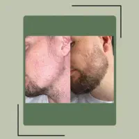 جیگر شو|آرایشی، بهداشتی، درمانی|یاسوج, |دیوار