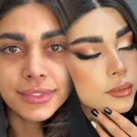 مدل|استخدام درمانی، زیبایی، بهداشتی|کرمان, |دیوار