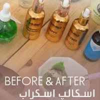 آموزش اسکراب اسکالپ سردرمشهد با مدرک رسمی